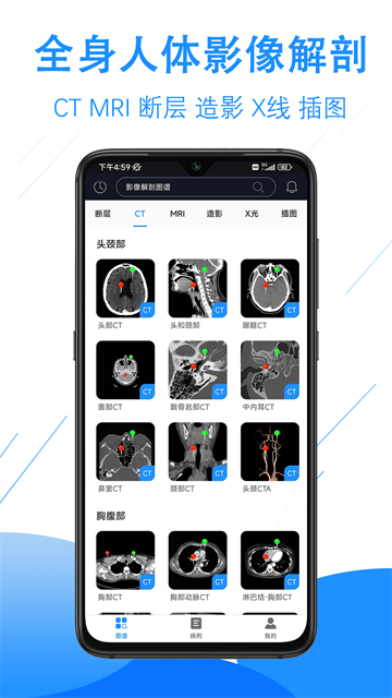 影像解剖图谱